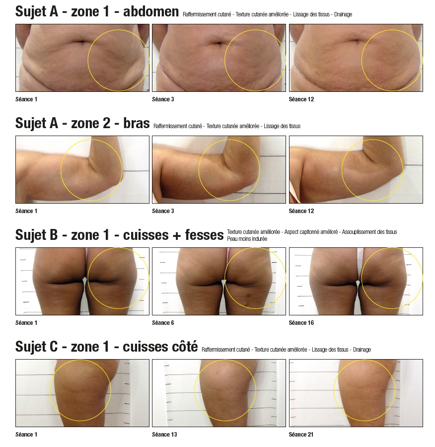 Soins Raffermissants & Anti-Cellulite